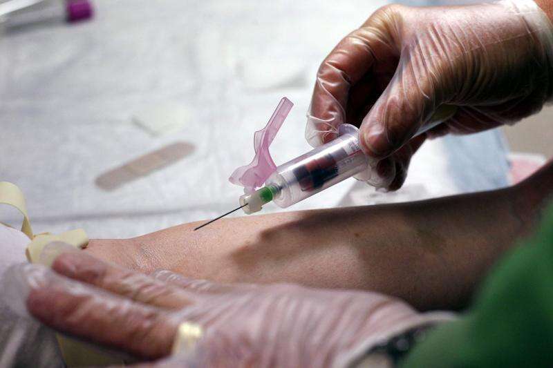 Beware of buying young people’s blood to prevent aging, FDA says