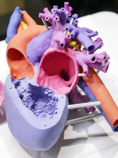 University of Iowa prototyping hub aims to win hearts and minds — by 3D printing them
