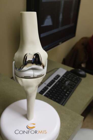 3-D technology provides custom fit, benefits in knee replacements