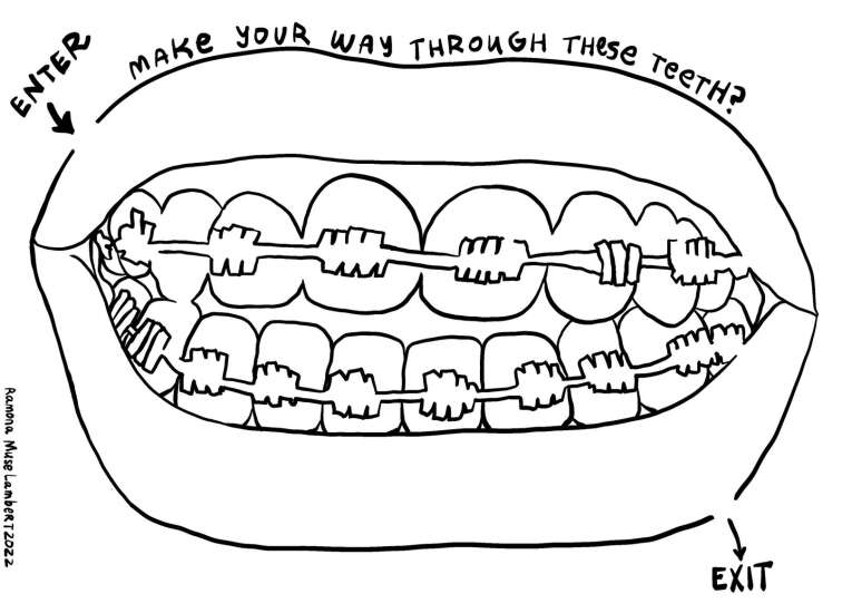 Can you get through this maze of braces?