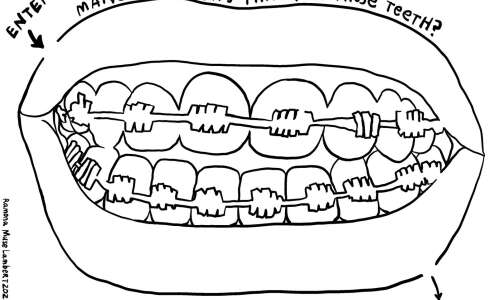 Can you get through this maze of braces?