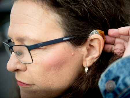 Hearing aids without prescription coming soon